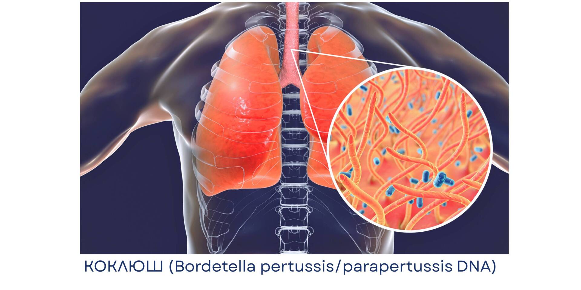 koklyush (Bordetella pertussisparapertussis DNA) (5)